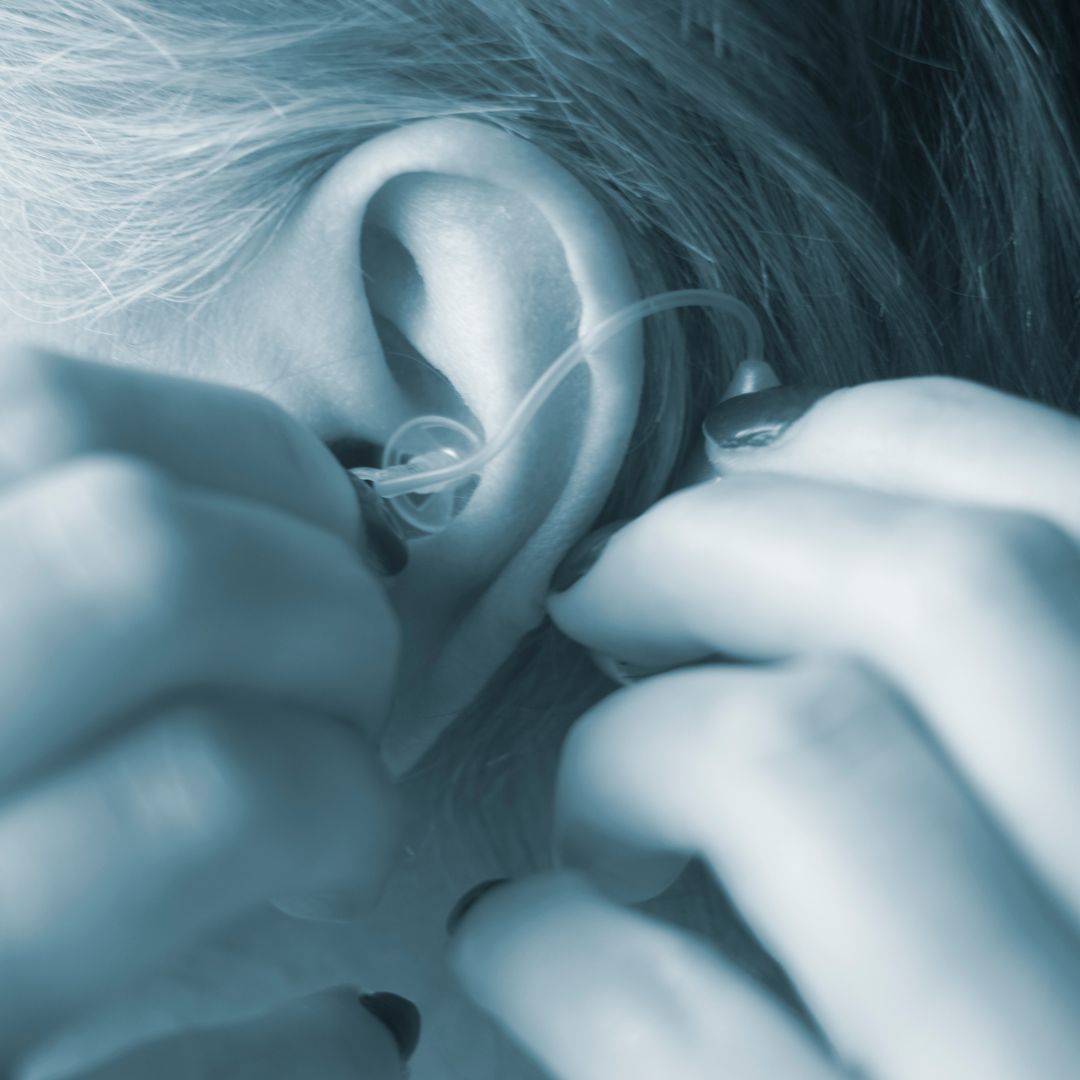 Understanding Hearing Aid Feedback: Effective Solutions for Whistling and Other Sounds